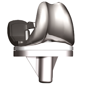 Knee Joint